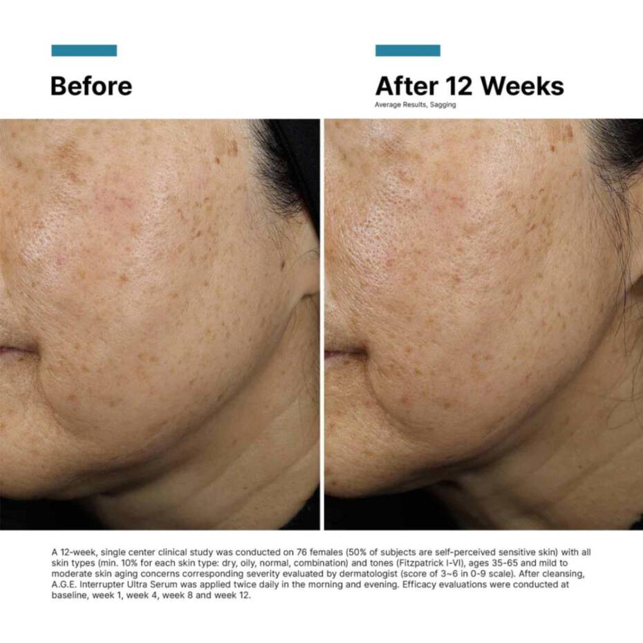 SkinCeuticals A.G.E. Interrupter Ultra Serum (Preorder)
