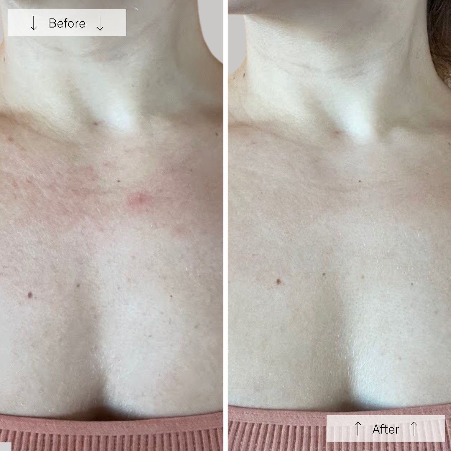 Omnilux Contour™ Neck & Décolleté LED Mask