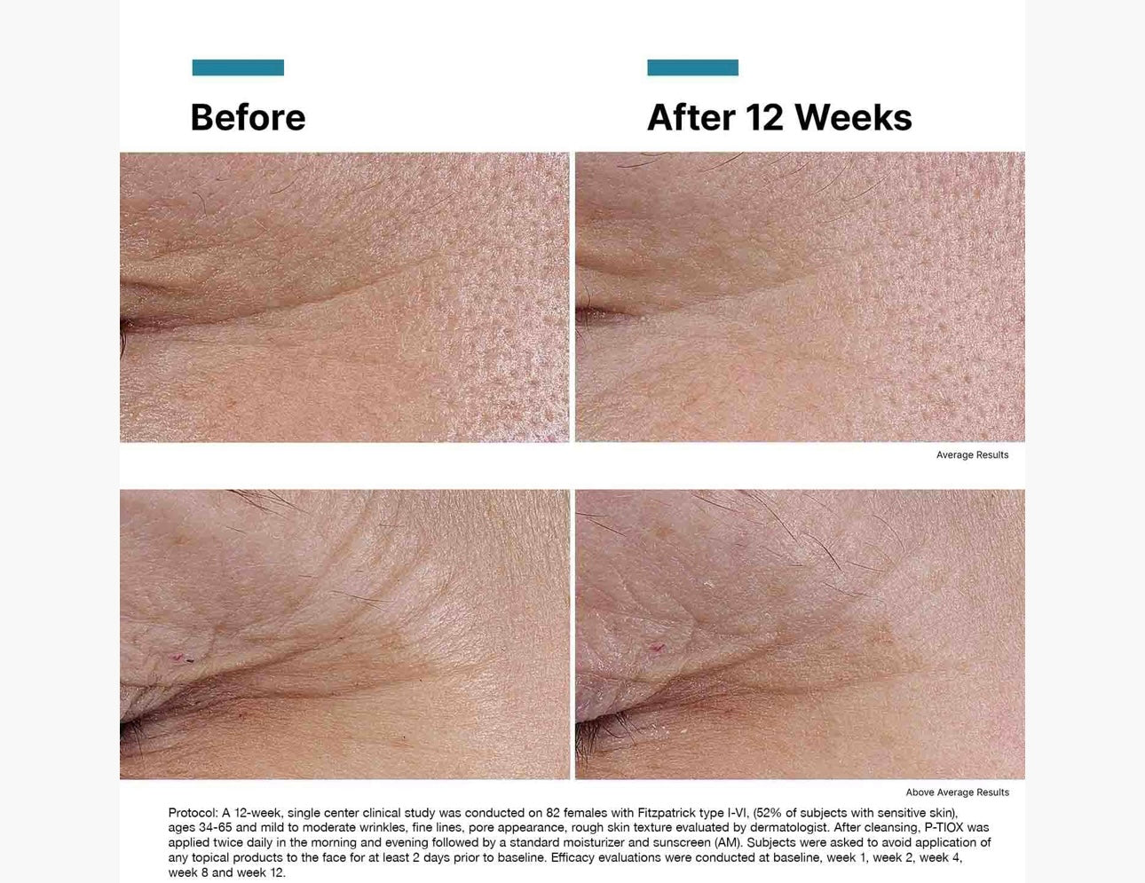 SkinCeuticals Injectables Duo