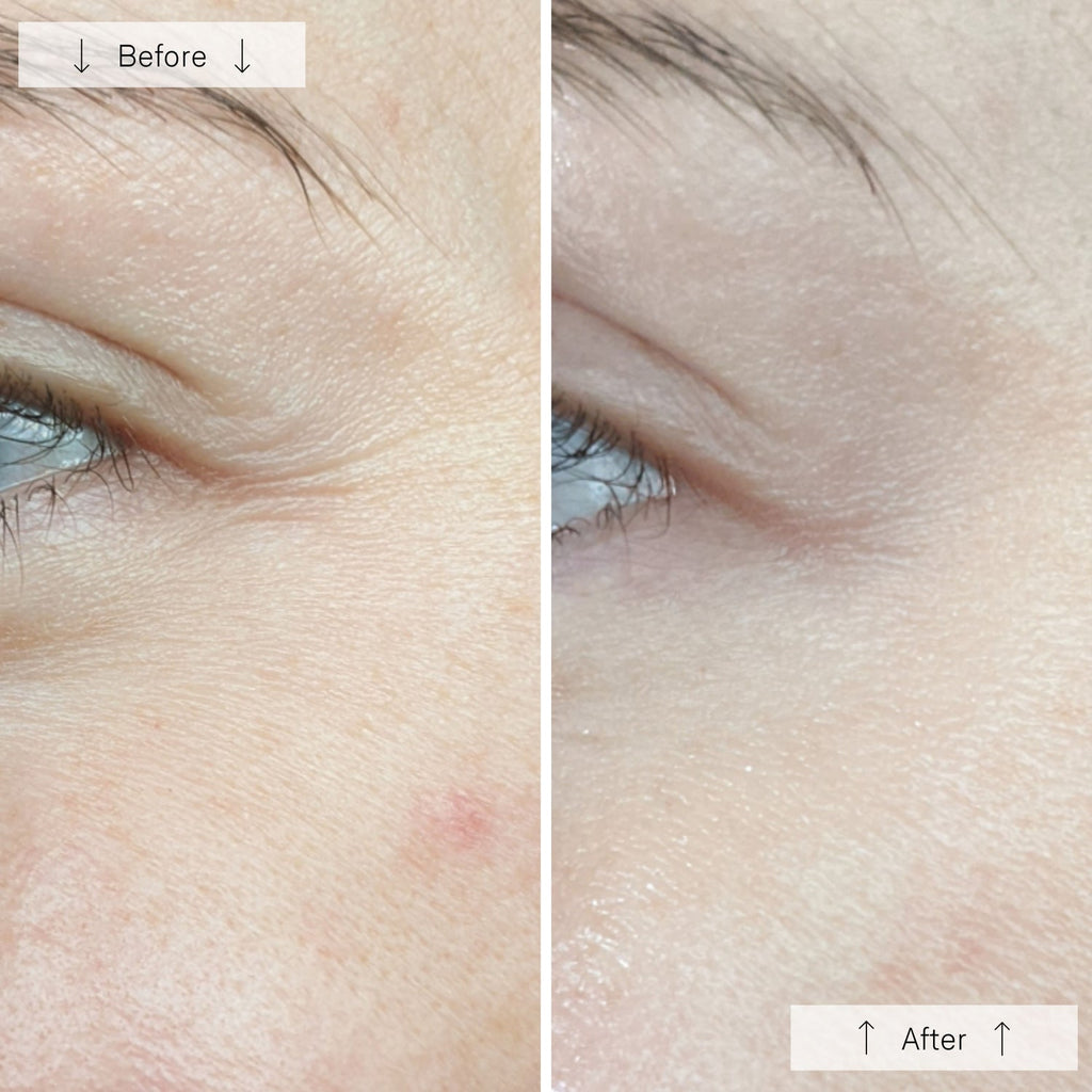 Omnilux Contour