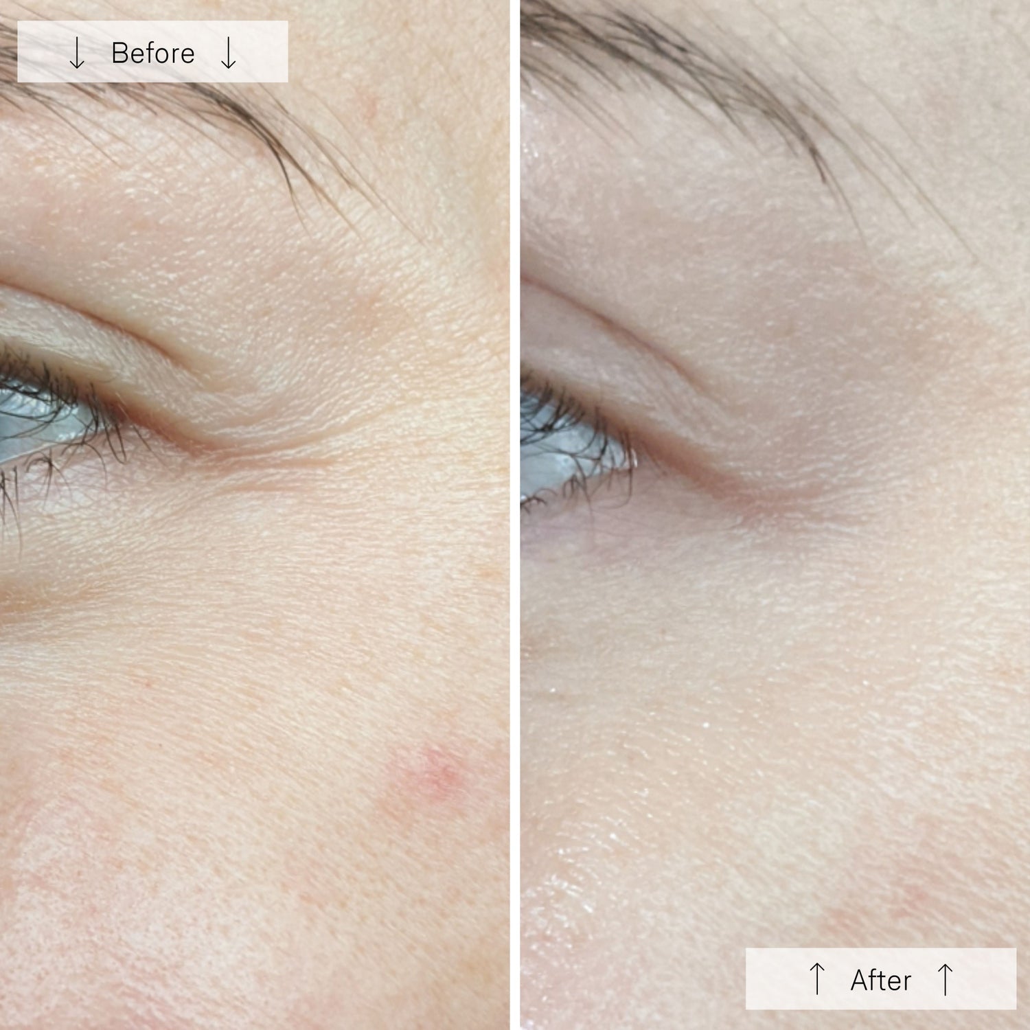 Omnilux Contour
