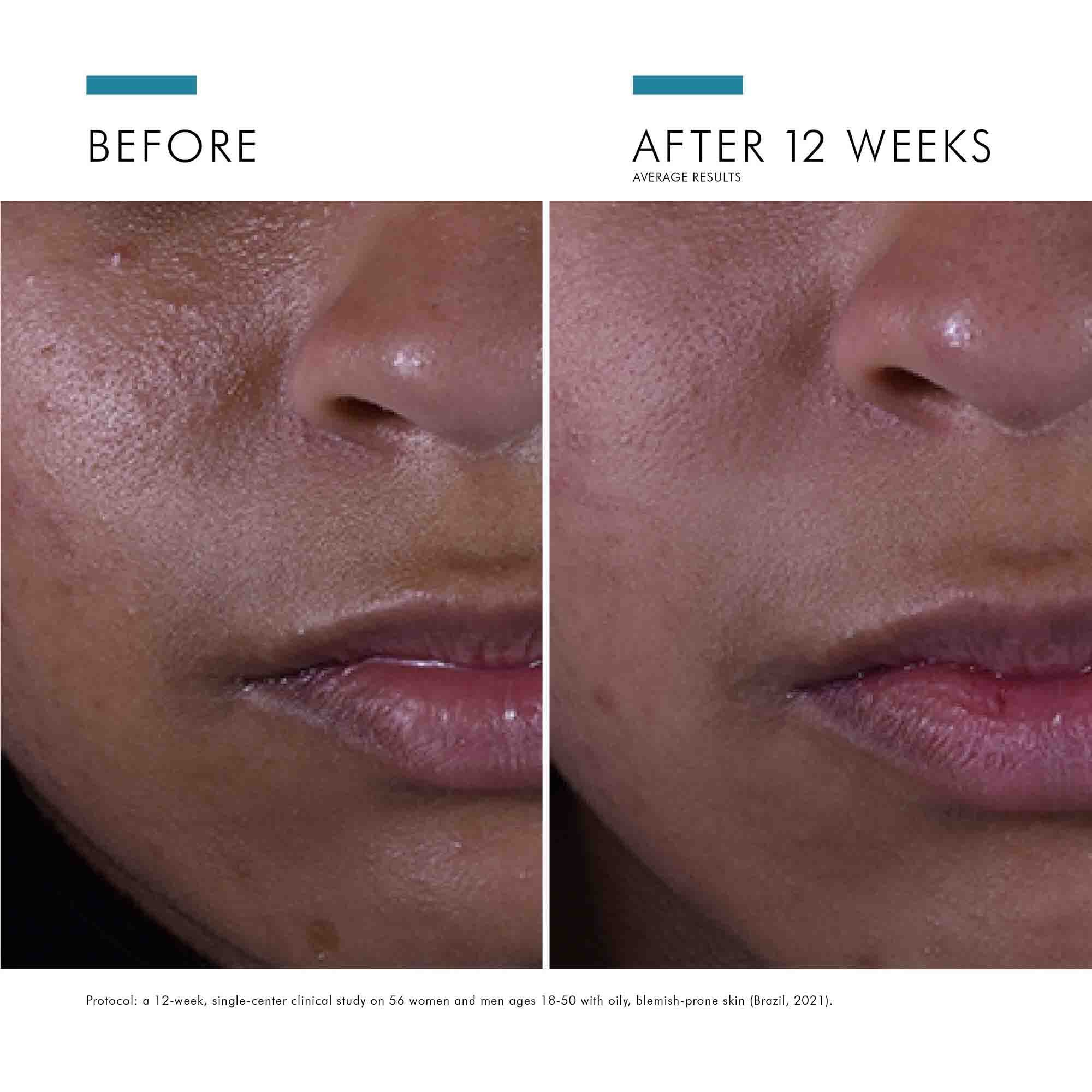 SkinCeuticals Silymarin CF Vitamin C Serum
