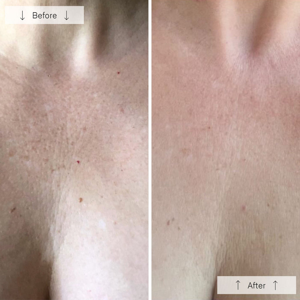 Omnilux Contour™ Neck & Décolleté LED Mask