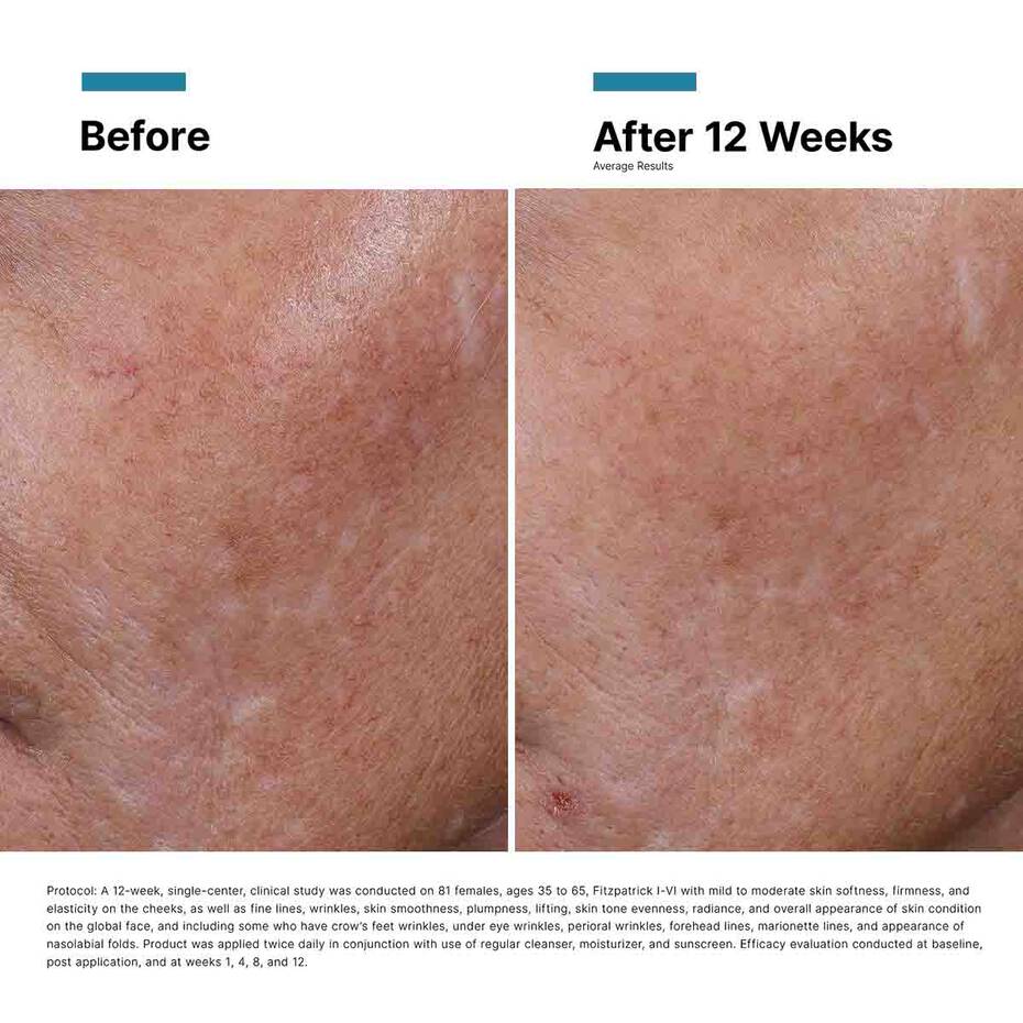 SkinCeuticals Injectables Duo