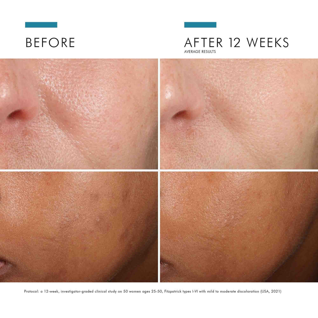 SkinCeuticals Phloretin CF with Ferulic Acid
