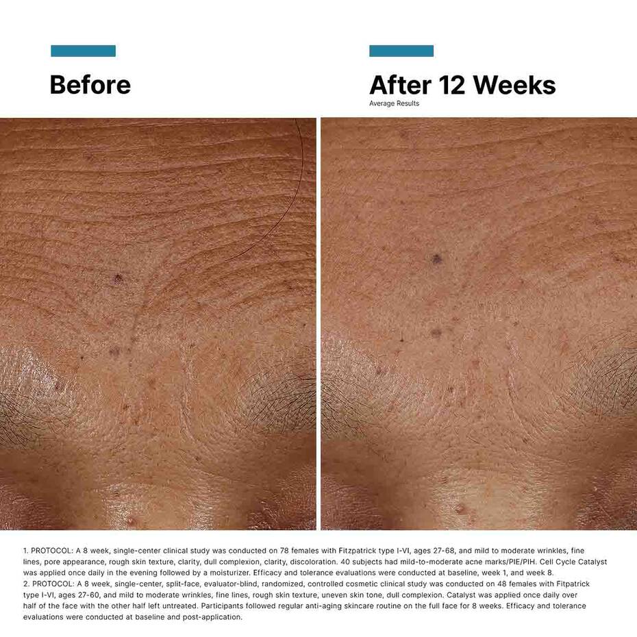 SkinCeuticals Injectables Duo