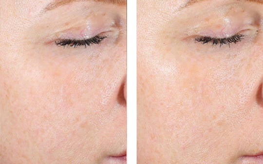 Skinbetter Science AlphaRet® Exfoliating Peel Pads