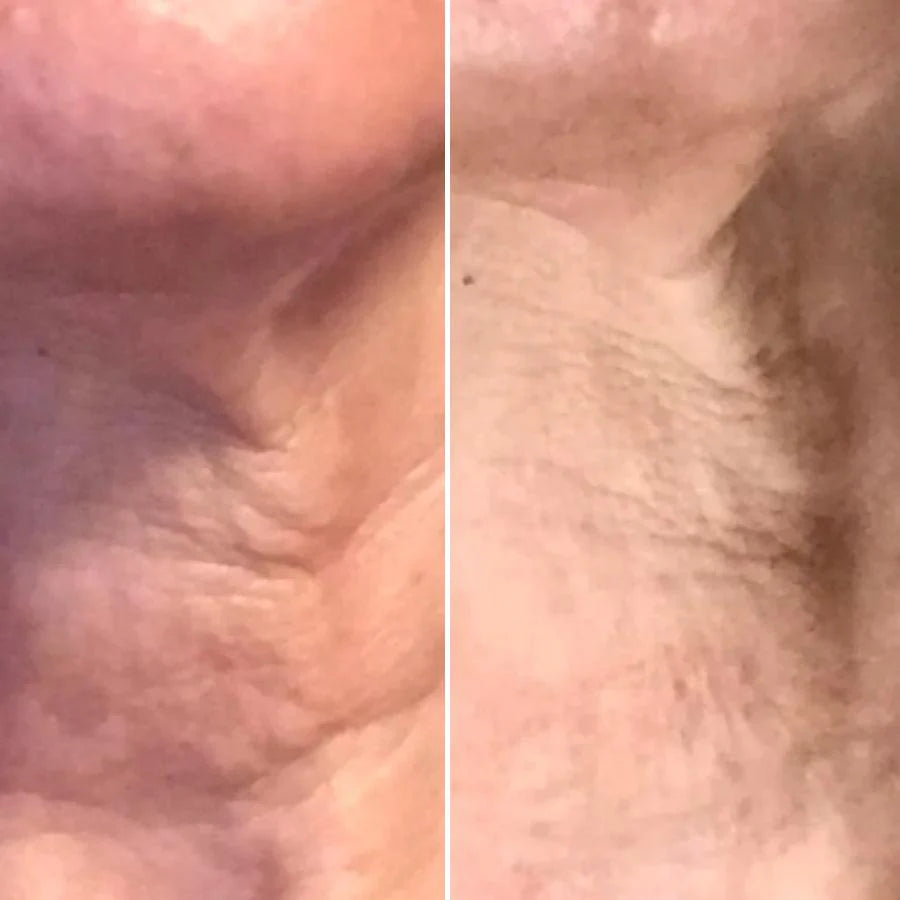 Omnilux Contour™ Neck & Décolleté LED Mask