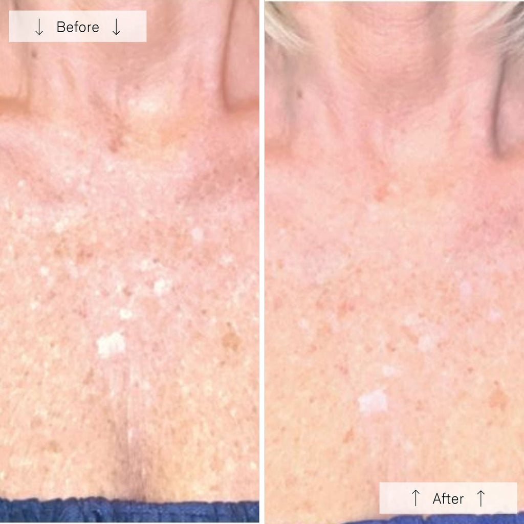 Omnilux Contour™ Neck & Décolleté LED Mask
