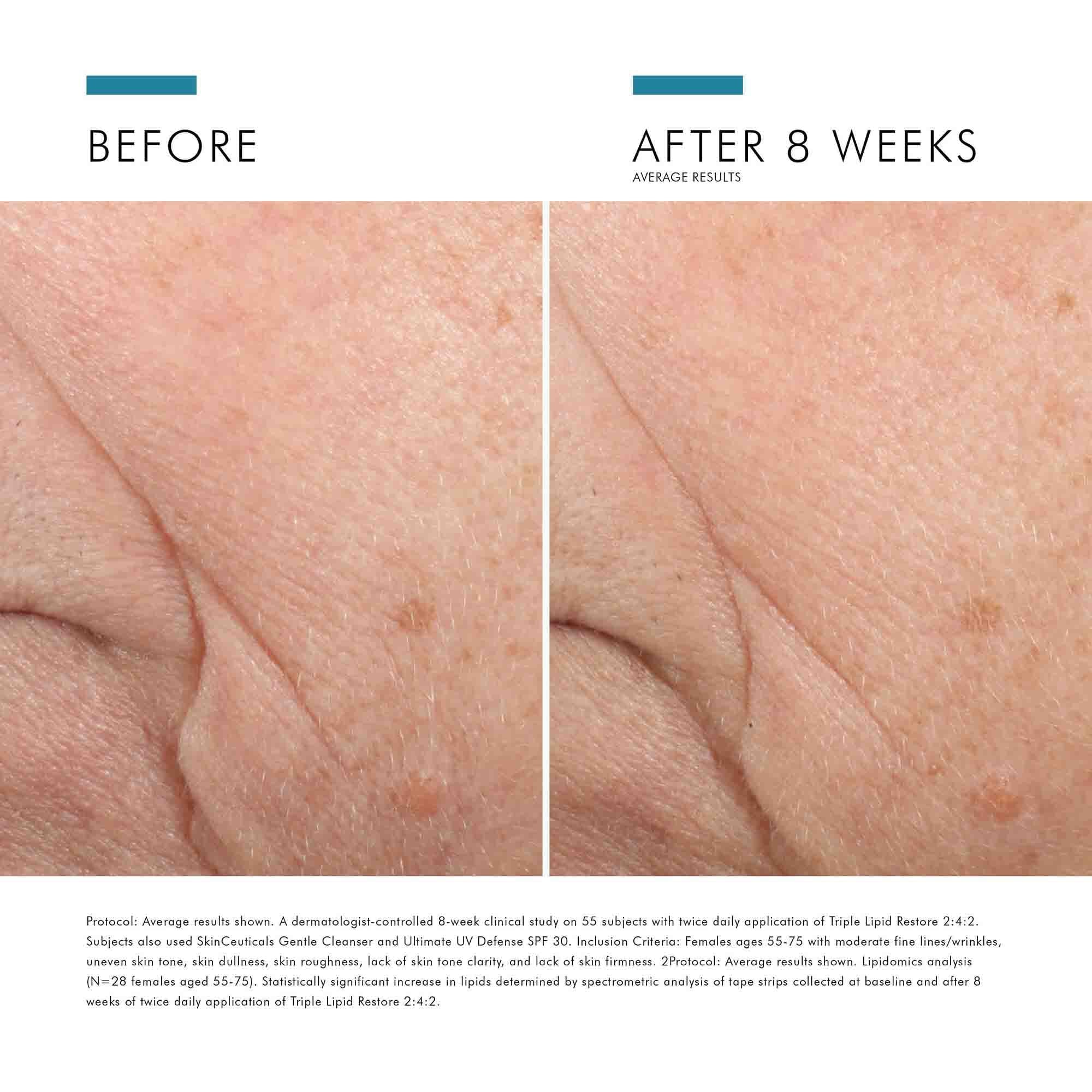 SkinCeuticals Triple Lipid Restore 2:4:2 | Taylor Caswell
