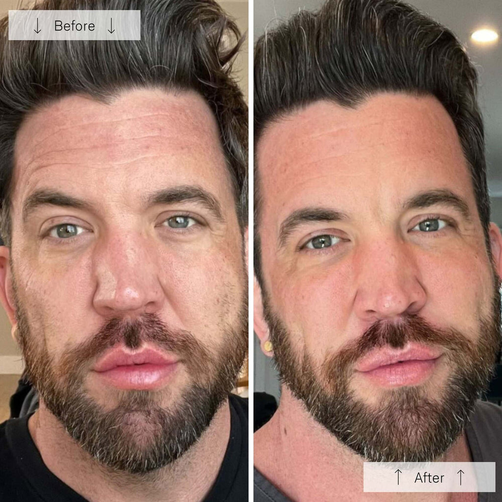 Omnilux Men™ LED Face Mask