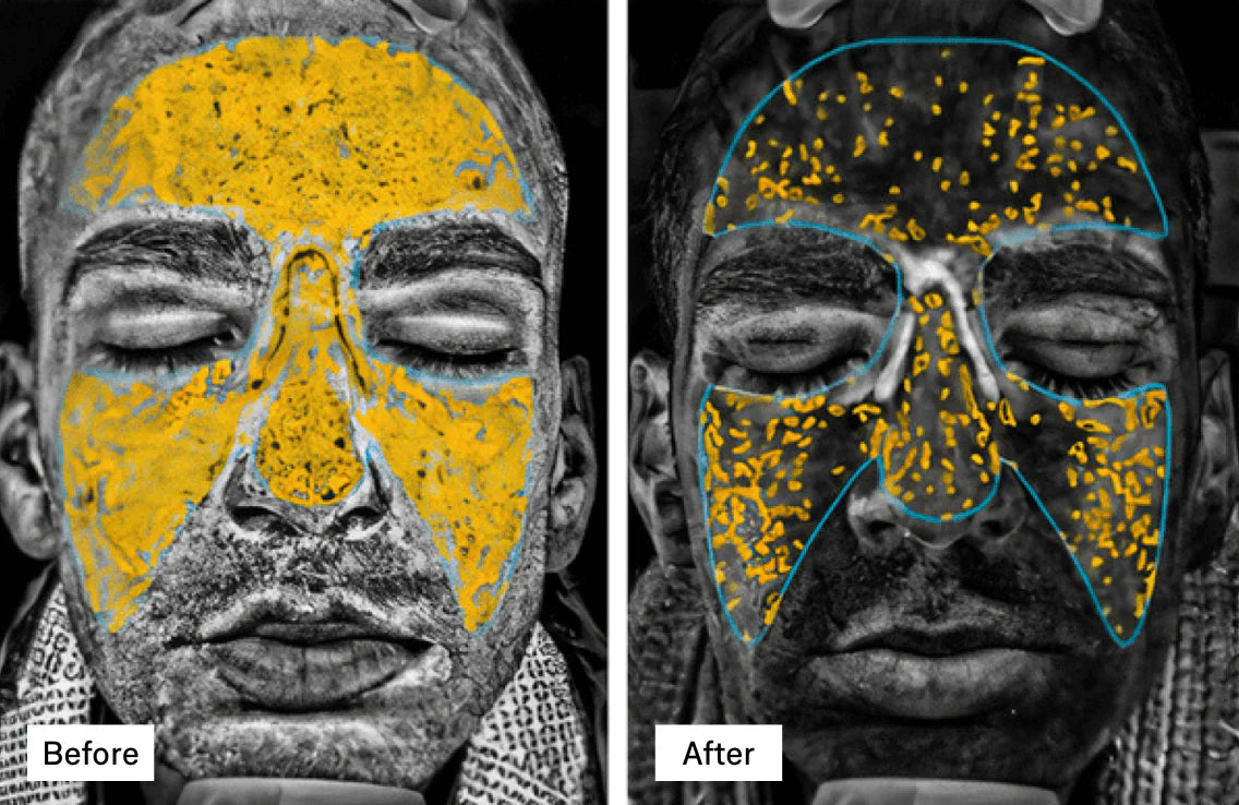 Omnilux Men™ LED Face Mask