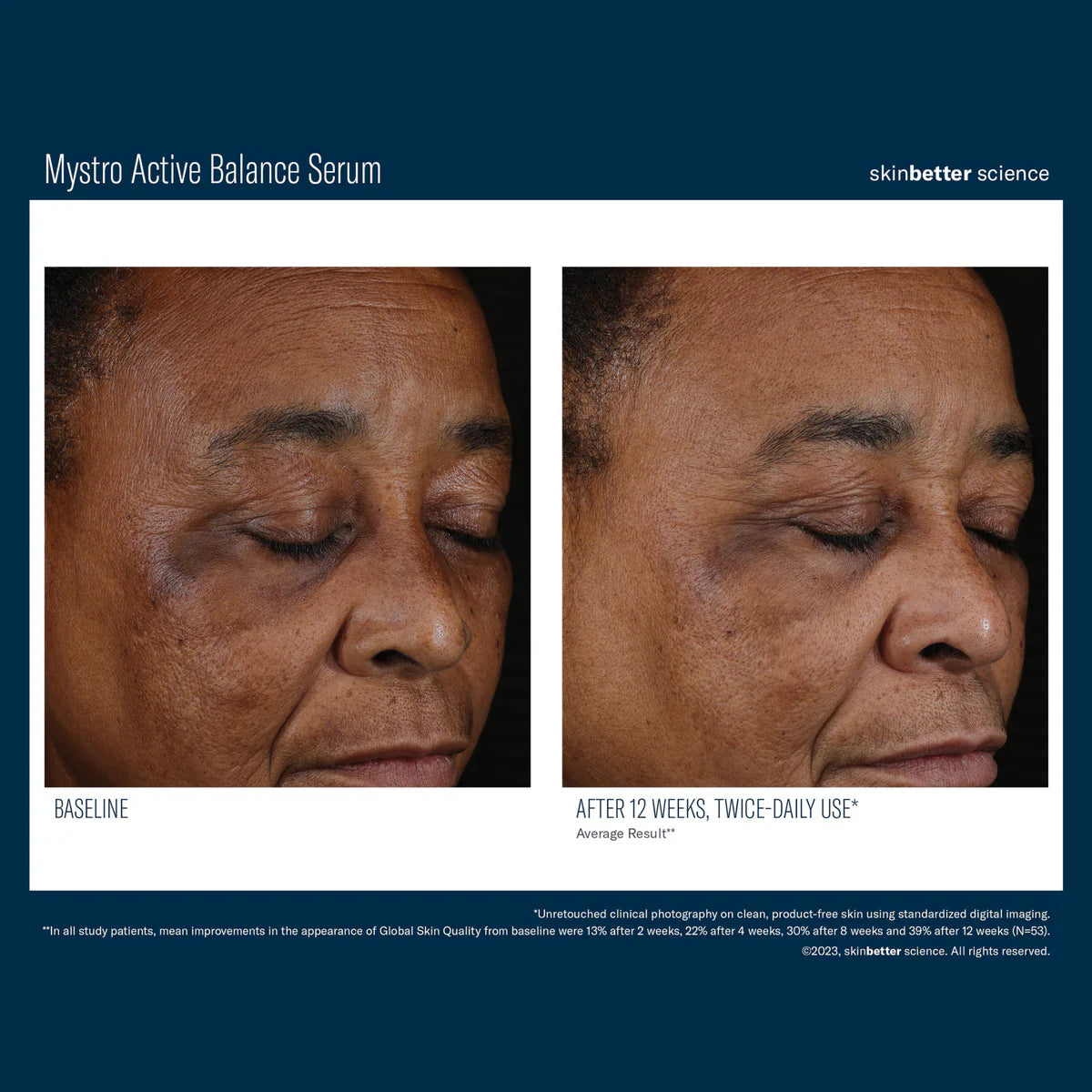 Skinbetter Science Mystro™ Active Balance Serum