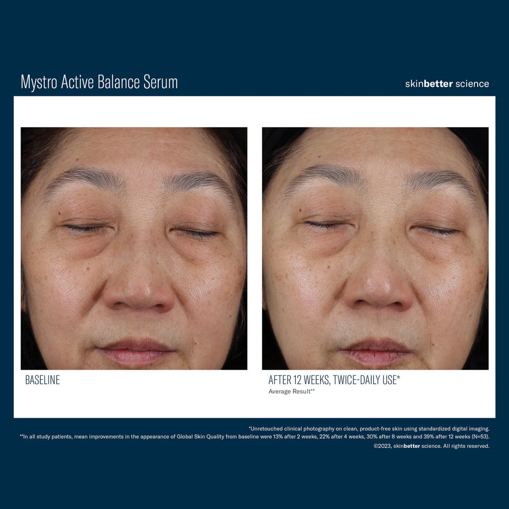 Skinbetter Science Mystro™ Active Balance Serum