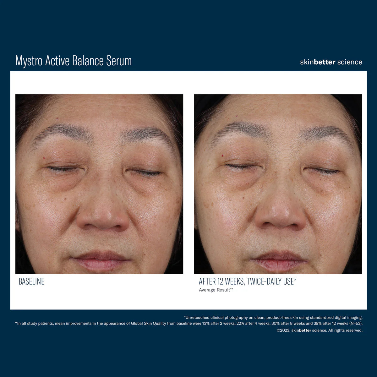 Skinbetter Science Mystro™ Active Balance Serum