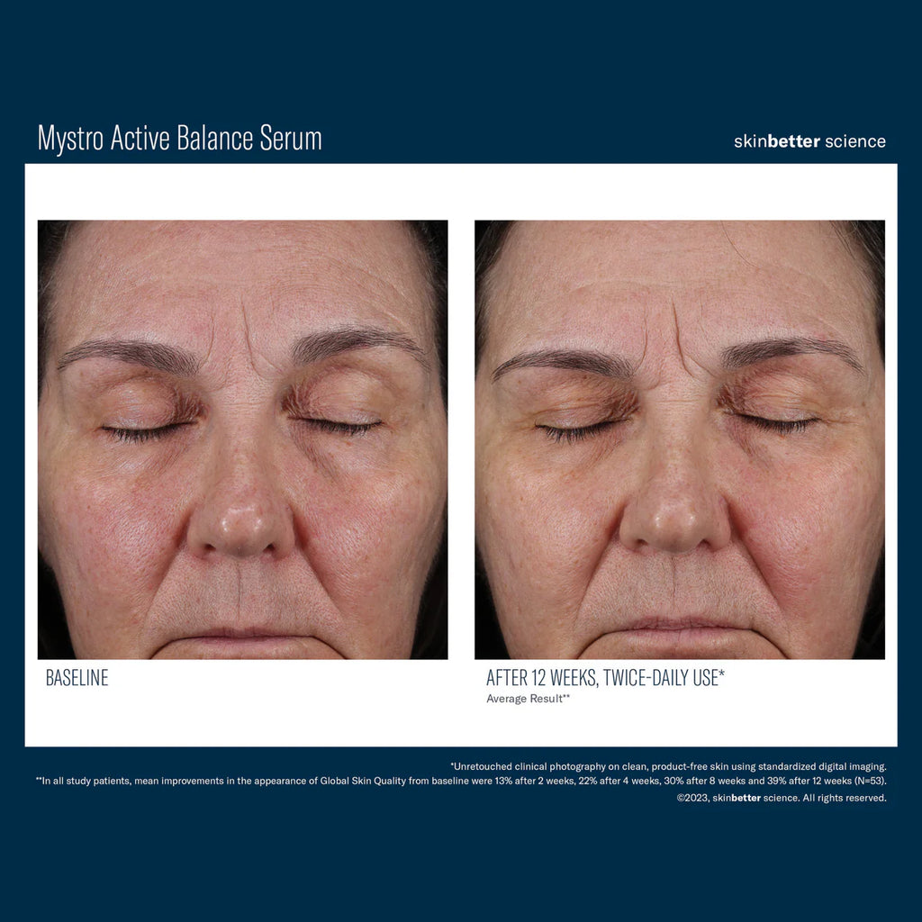 Skinbetter Science Mystro™ Active Balance Serum