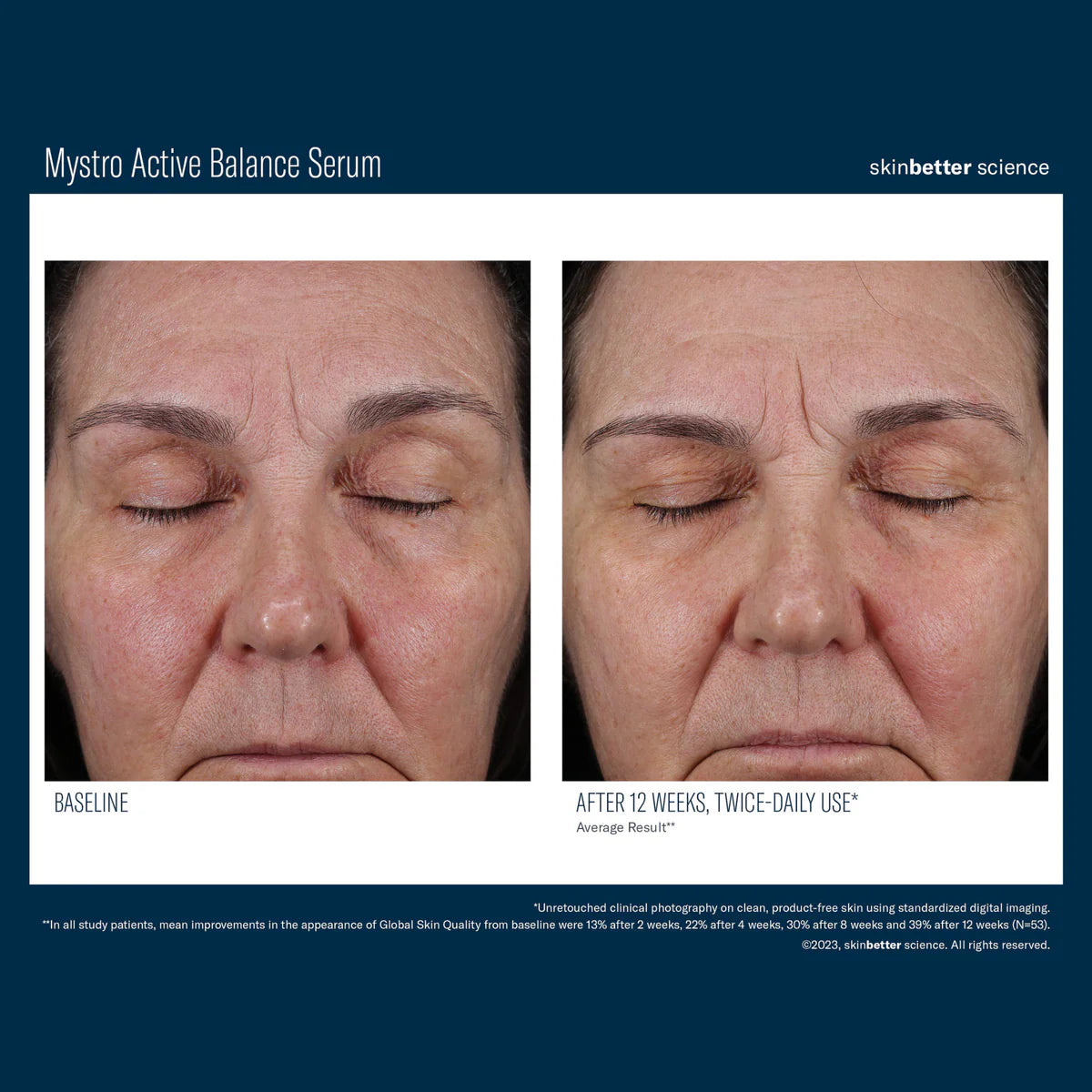 Skinbetter Science Mystro™ Active Balance Serum