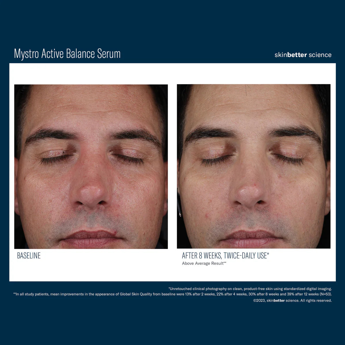 Skinbetter Science Mystro™ Active Balance Serum