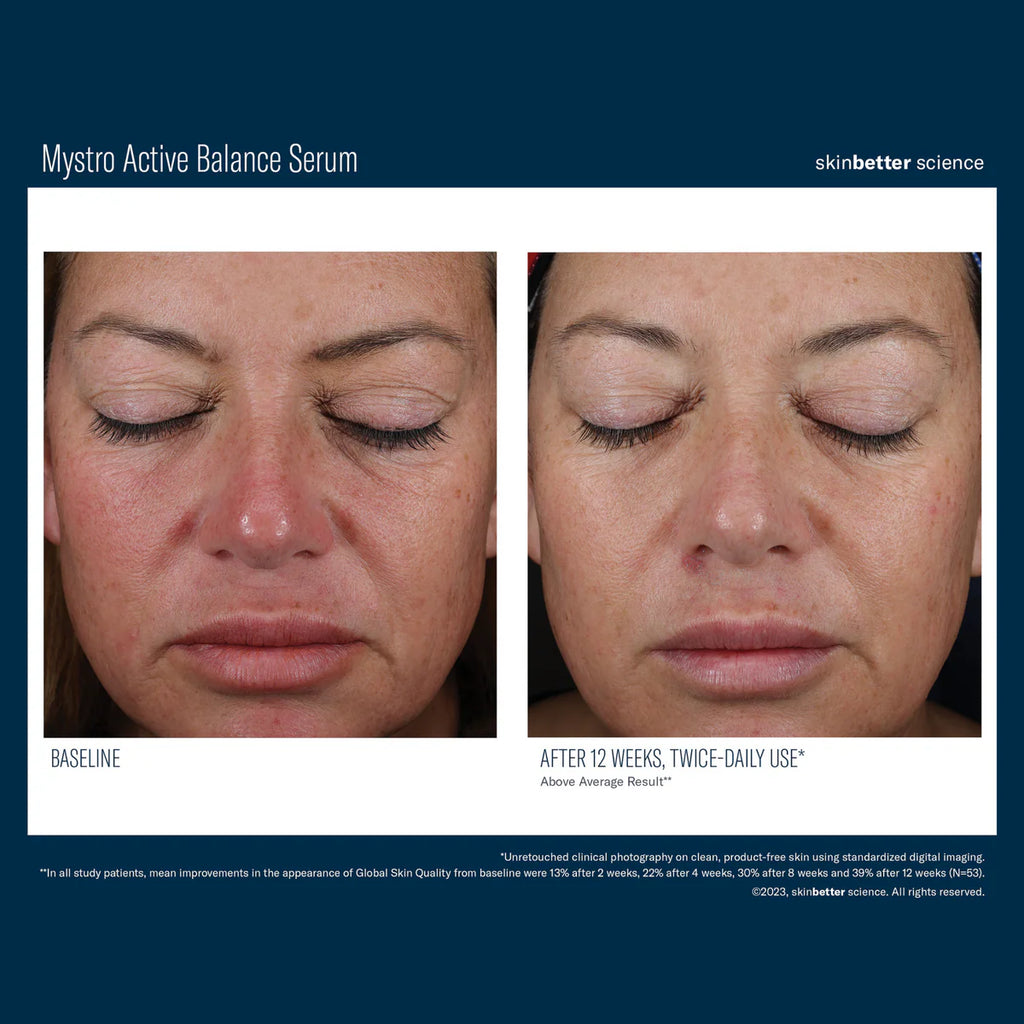 Skinbetter Science Mystro™ Active Balance Serum