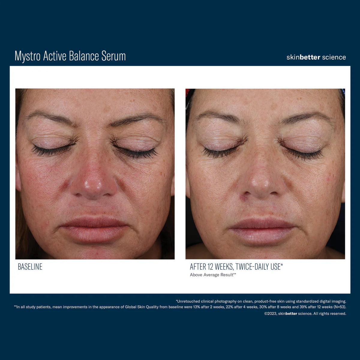 Skinbetter Science Mystro™ Active Balance Serum