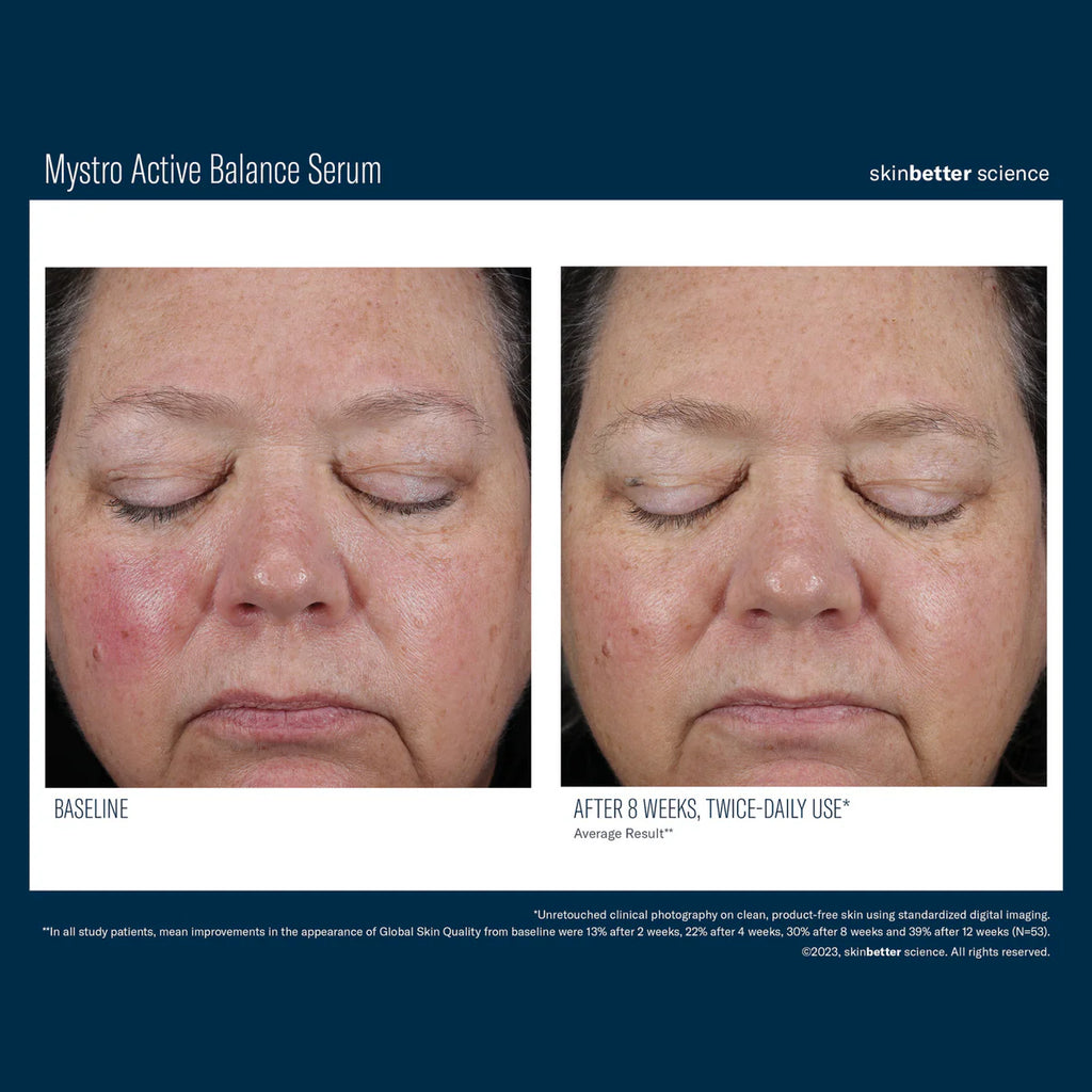 Skinbetter Science Mystro™ Active Balance Serum