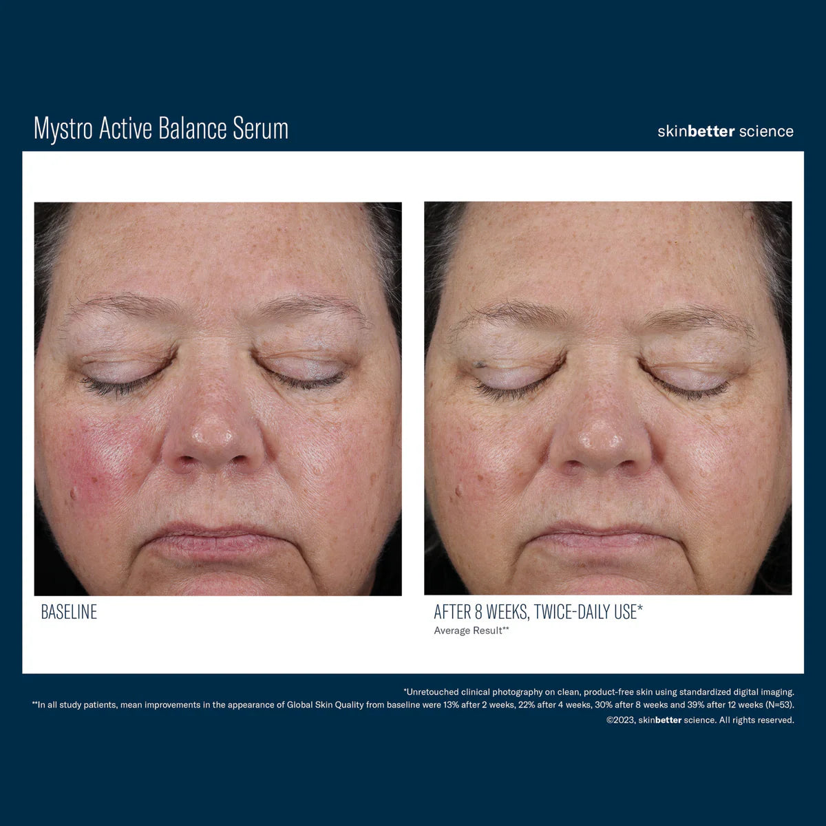 Skinbetter Science Mystro™ Active Balance Serum