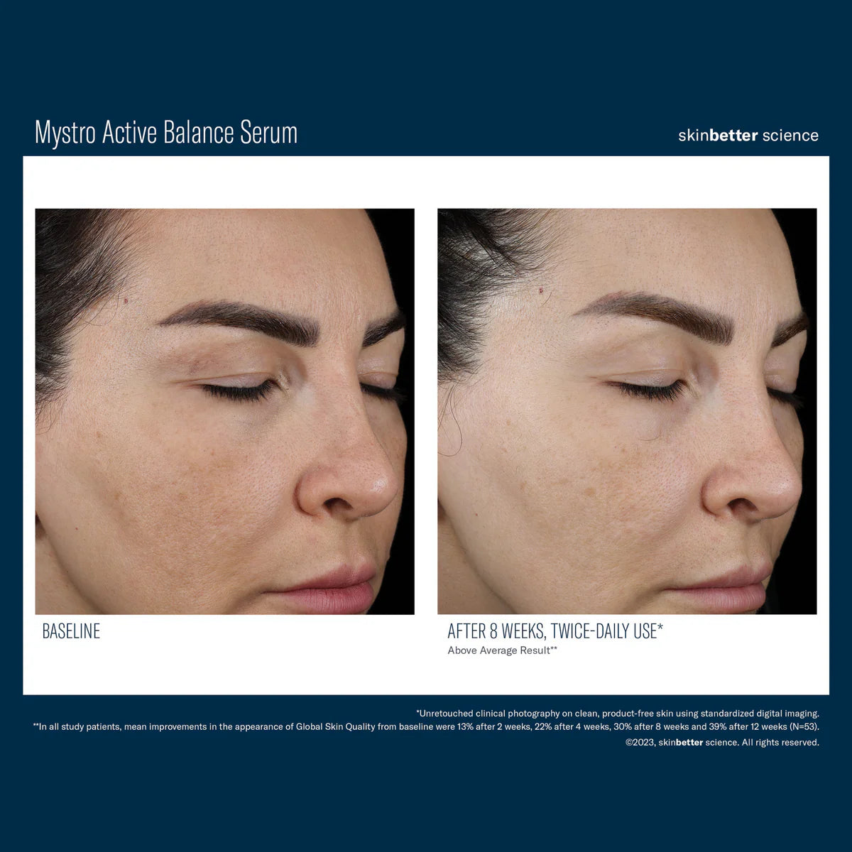 Skinbetter Science Mystro™ Active Balance Serum