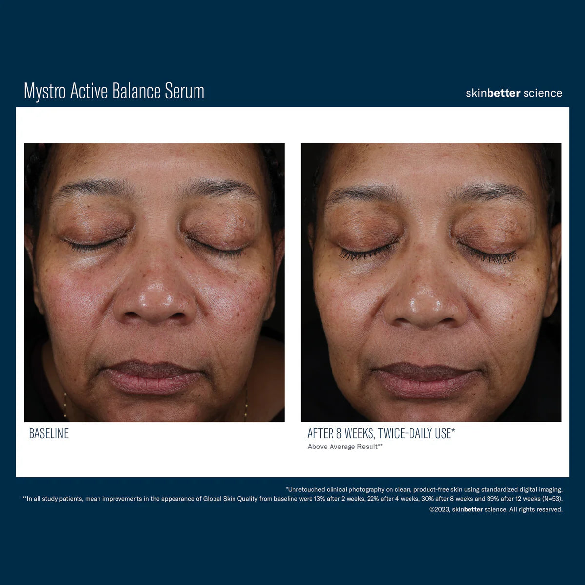 Skinbetter Science Mystro™ Active Balance Serum