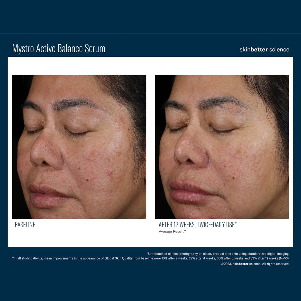 Skinbetter Science Mystro™ Active Balance Serum