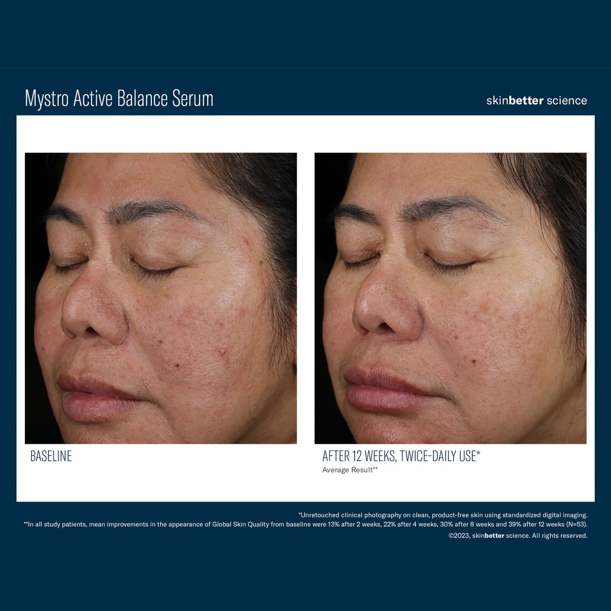 Skinbetter Science Mystro™ Active Balance Serum