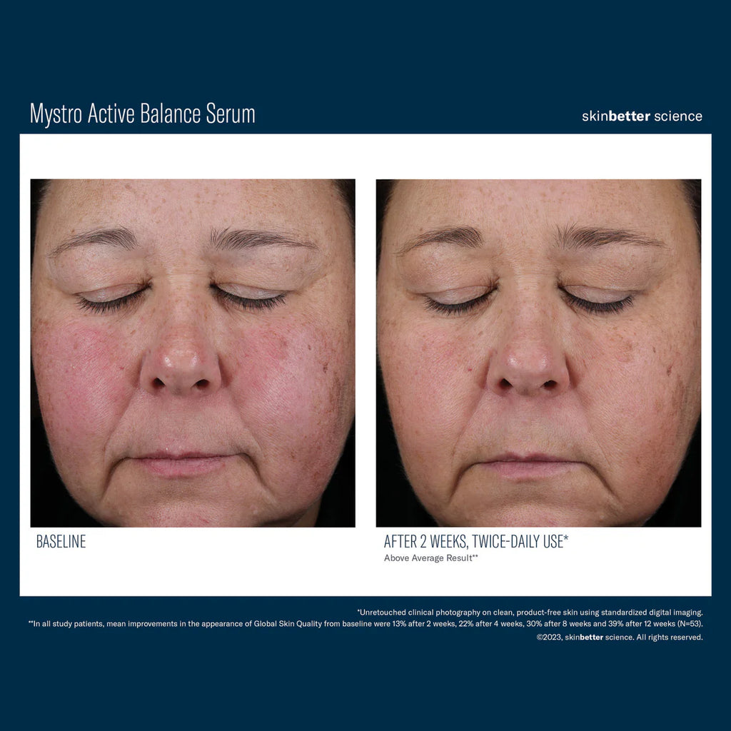 Skinbetter Science Mystro™ Active Balance Serum