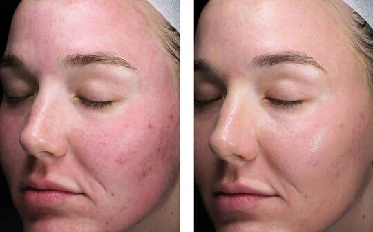 Skinbetter Science Sunbetter Tone Smart SPF 75 Tinted Sunscreen