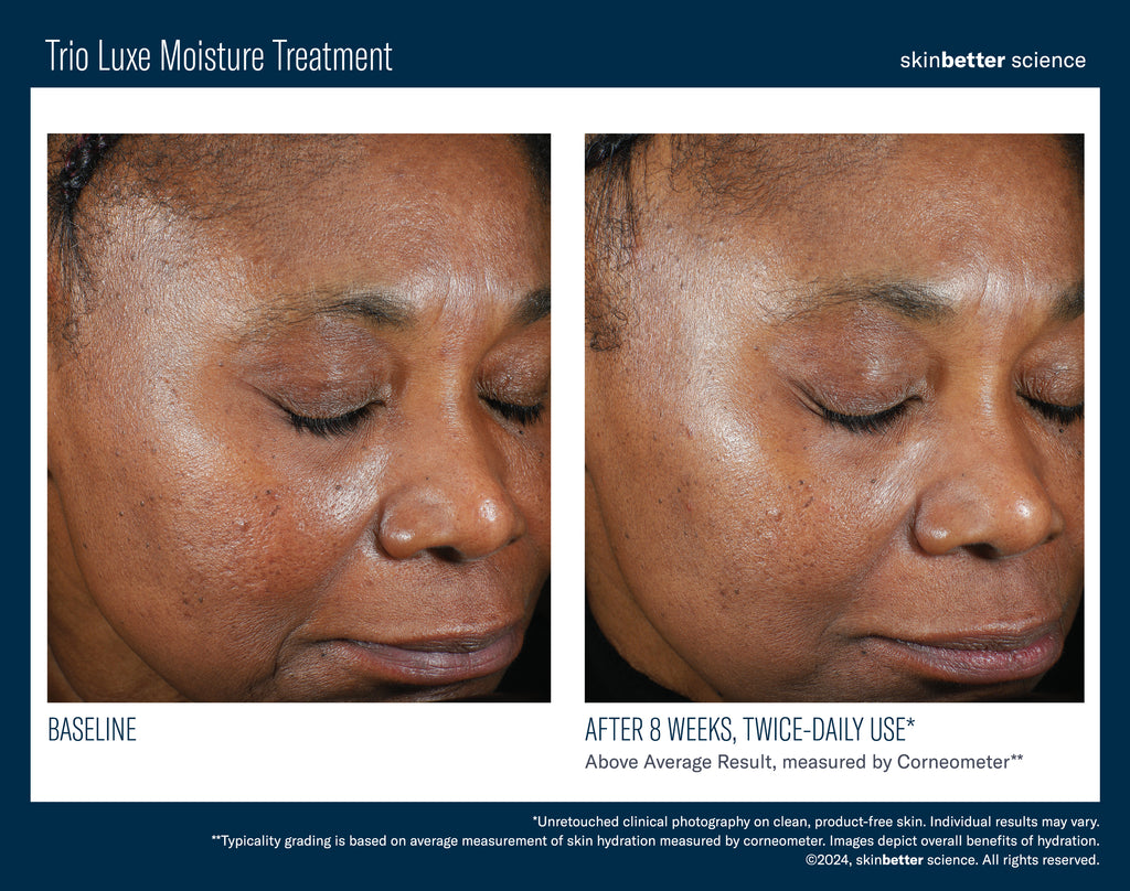 Skinbetter Science Trio Luxe Moisture Treatment | Rich Hydrating Moisturizer | 50 mL