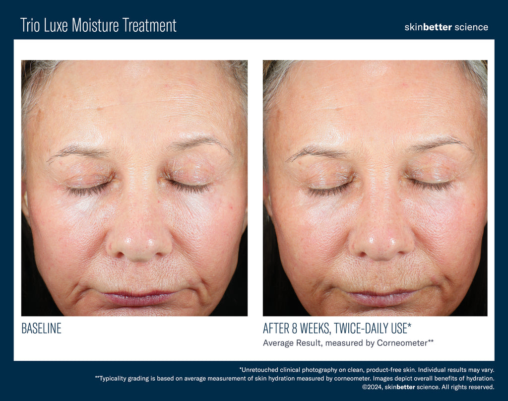 Skinbetter Science Trio Luxe Moisture Treatment | Rich Hydrating Moisturizer | 50 mL