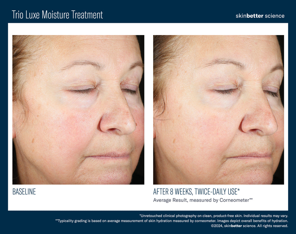 Skinbetter Science Trio Luxe Moisture Treatment | Rich Hydrating Moisturizer | 50 mL